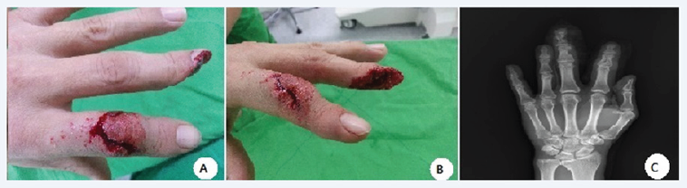 Click here to view Large Figure 1