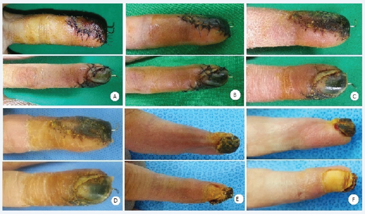 Click here to view Large Figure 2