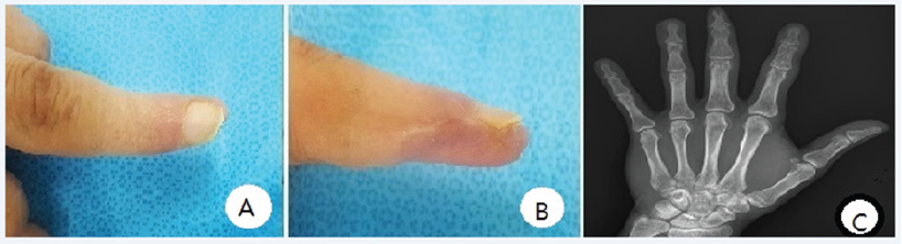 Click here to view Large Figure 3