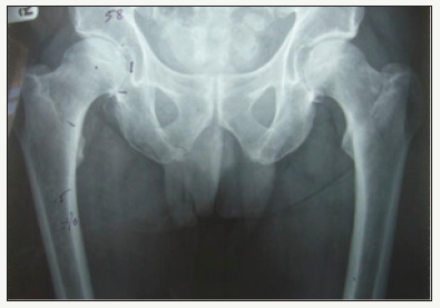 Click here to view Large image 1