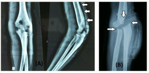 Click here to view Large image 2