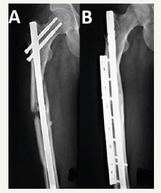 Click here to view Large image 1