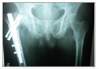 Click here to view Large image 15