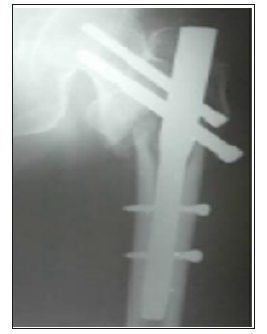 Click here to view Large image 17