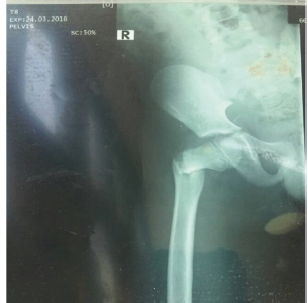 Click here to view Large image 2