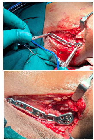 Click here to view Large image 1