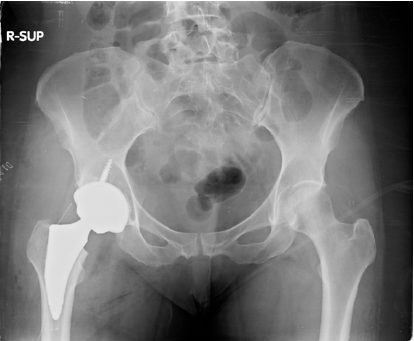 Click here to view Large image 6