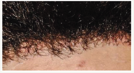 Click here to view Large Figure 1