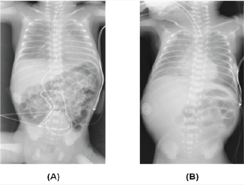 Click here to view Large Figure 1