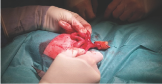 Click here to view Large Figure 1