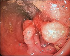 Click here to view Large Figure 1