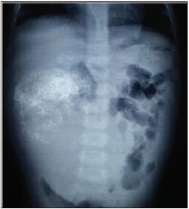 Click here to view Large image 1