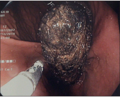 Click here to view Large image 1