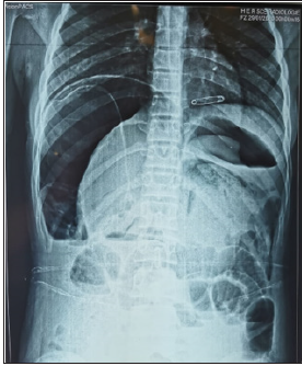 Click here to view Large image 1