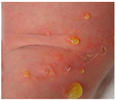 Click here to view Large image 1