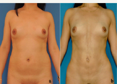 Click here to view Large Figure 14