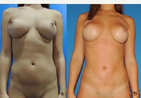 Click here to view Large Figure 15