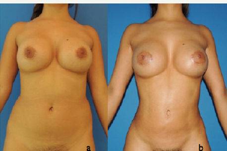 Click here to view Large Figure 17