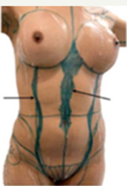 Click here to view Large Figure 4