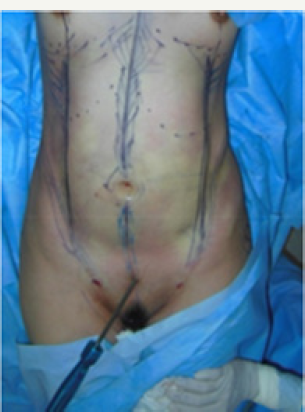 Click here to view Large Figure 6