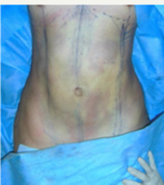 Click here to view Large Figure 7