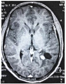 Click here to view Large Figure 1