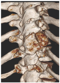 Click here to view Large Figure 4