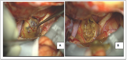 Click here to view Large Figure 1