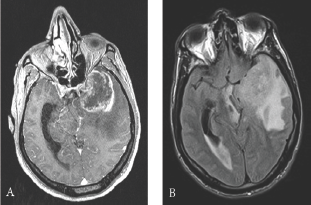 Click here to view Large Figure 1