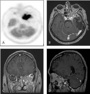 Click here to view Large Figure 3