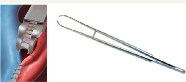 Click here to view Large Figure 3