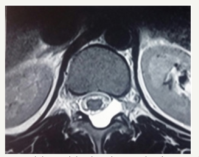 Click here to view Large Figure 1c