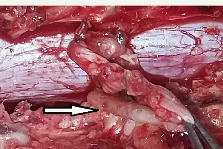 Click here to view Large Figure 4a