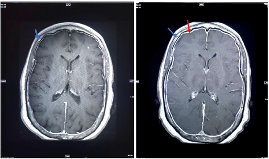 Click here to view Large image 1